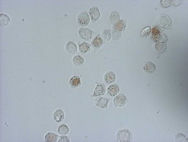IdU / Iododeoxyuridine Antibody - Immunocytochemistry staining of HT-29 cells pulsed with 5-iodo-2'-deoxyuridine (IdU)using mouse monoclonal anti-IDU antibody (1:150).