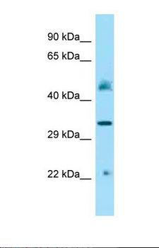 IDUA / MPS1 Antibody - Western blot of Mouse Kidney lysate. IDUA antibody dilution 1.0 ug/ml.  This image was taken for the unconjugated form of this product. Other forms have not been tested.