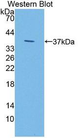 IDUA / MPS1 Antibody - Western blot of IDUA / MPS1 antibody.