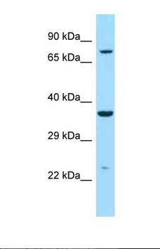 IDUA / MPS1 Antibody - Western blot of Human ACHN . IDUA antibody dilution 1.0 ug/ml.  This image was taken for the unconjugated form of this product. Other forms have not been tested.