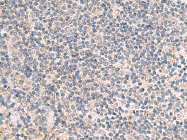 IDUA / MPS1 Antibody - Immunohistochemistry of paraffin-embedded Human tonsil tissue  using IDUA Polyclonal Antibody at dilution of 1:35(×200)