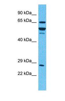 IDUA / MPS1 Antibody - Western blot of IDUA Antibody with human 293T Whole Cell lysate.  This image was taken for the unconjugated form of this product. Other forms have not been tested.