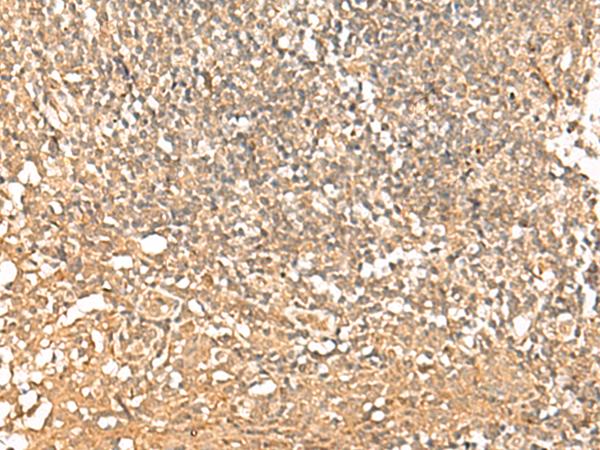 IEF-SSP-9502 / PWP1 Antibody - Immunohistochemistry of paraffin-embedded Human tonsil tissue  using PWP1 Polyclonal Antibody at dilution of 1:50(×200)