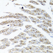 IER3 / IEX-1 Antibody - Immunohistochemistry of paraffin-embedded mouse stomach tissue.