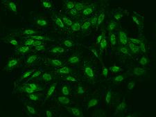 IER5 Antibody - Immunofluorescence staining of IER5 in U251MG cells. Cells were fixed with 4% PFA, permeabilzed with 0.1% Triton X-100 in PBS, blocked with 10% serum, and incubated with rabbit anti-Human IER5 polyclonal antibody (dilution ratio 1:100) at 4°C overnight. Then cells were stained with the Alexa Fluor 488-conjugated Goat Anti-rabbit IgG secondary antibody (green). Positive staining was localized to Nucleus.