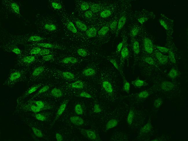 IER5 Antibody - Immunofluorescence staining of IER5 in U251MG cells. Cells were fixed with 4% PFA, permeabilzed with 0.1% Triton X-100 in PBS, blocked with 10% serum, and incubated with rabbit anti-Human IER5 polyclonal antibody (dilution ratio 1:100) at 4°C overnight. Then cells were stained with the Alexa Fluor 488-conjugated Goat Anti-rabbit IgG secondary antibody (green). Positive staining was localized to Nucleus.