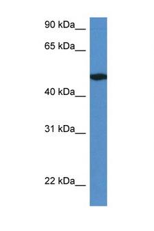 IER5L Antibody - IER5L antibody Western blot of Mouse Pancreas lysate. Antibody concentration 1 ug/ml. This image was taken for the unconjugated form of this product. Other forms have not been tested.