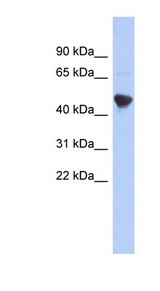IER5L Antibody - IER5L antibody Western blot of NCI-H226 cell lysate. This image was taken for the unconjugated form of this product. Other forms have not been tested.