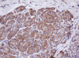 IF3mt / MTIF3 Antibody - IHC of paraffin-embedded Human pancreas tissue using anti-MTIF3 mouse monoclonal antibody. (Heat-induced epitope retrieval by 10mM citric buffer, pH6.0, 100C for 10min).