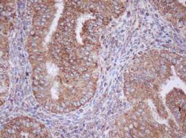 IF3mt / MTIF3 Antibody - IHC of paraffin-embedded Human endometrium tissue using anti-MTIF3 mouse monoclonal antibody. (Heat-induced epitope retrieval by 10mM citric buffer, pH6.0, 100C for 10min).