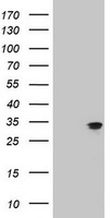 IF3mt / MTIF3 Antibody - HEK293T cells were transfected with the pCMV6-ENTRY control (Left lane) or pCMV6-ENTRY MTIF3 (Right lane) cDNA for 48 hrs and lysed. Equivalent amounts of cell lysates (5 ug per lane) were separated by SDS-PAGE and immunoblotted with anti-MTIF3.