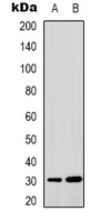 IF3mt / MTIF3 Antibody - Western blot analysis of MTIF3 expression in HepG2 (A); HUVEC (B) whole cell lysates.