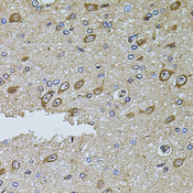 IF3mt / MTIF3 Antibody - Immunohistochemistry of paraffin-embedded rat brain tissue.