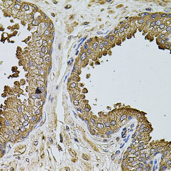 IF3mt / MTIF3 Antibody - Immunohistochemistry of paraffin-embedded human prostate tissue.