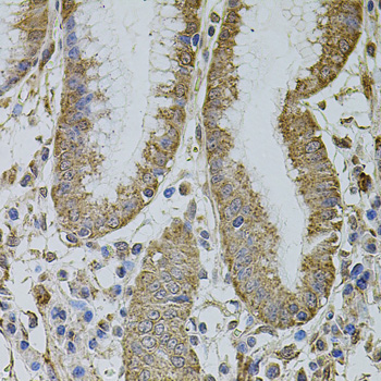 IF3mt / MTIF3 Antibody - Immunohistochemistry of paraffin-embedded human stomach tissue.