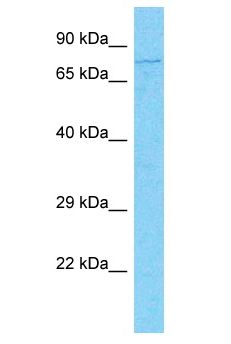 IFI16 Antibody - IFI16 antibody Western Blot of Jurkat. Antibody dilution: 1 ug/ml.  This image was taken for the unconjugated form of this product. Other forms have not been tested.
