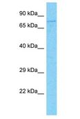 IFI16 Antibody - IFI16 antibody Western Blot of Jurkat. Antibody dilution: 1 ug/ml.  This image was taken for the unconjugated form of this product. Other forms have not been tested.
