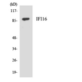 IFI16 Antibody - Western blot analysis of the lysates from HepG2 cells using IFI16 antibody.