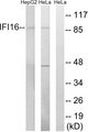 IFI16 Antibody - Western blot analysis of lysates from HeLa and HepG2 cells, using IFI16 Antibody. The lane on the right is blocked with the synthesized peptide.