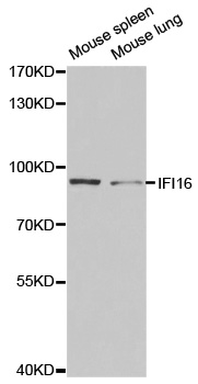IFI16 Antibody - Western blot analysis of extracts of various cell lines, using IFI16 antibody.