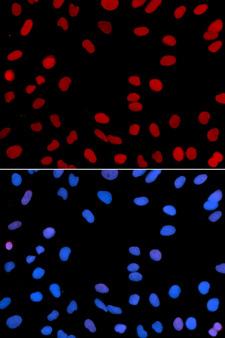 IFI16 Antibody - Immunofluorescence analysis of U2OS cell using IFI16 antibody. Blue: DAPI for nuclear staining.