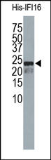 IFI16 Antibody - The IFI16 Antibody is used in Western blot at 1:5000 dilution to detect purified recombinant human His-IFI16[6-102].