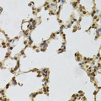 IFI16 Antibody - Immunohistochemistry of paraffin-embedded rat lung using IFI16 Antibody at dilution of 1:100 (40x lens).