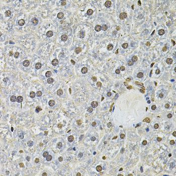 IFI16 Antibody - Immunohistochemistry of paraffin-embedded mouse liver using IFI16 Antibody at dilution of 1:100 (40x lens).