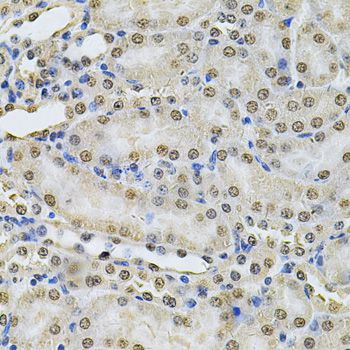 IFI16 Antibody - Immunohistochemistry of paraffin-embedded mouse kidney using IFI16 Antibody at dilution of 1:100 (40x lens).