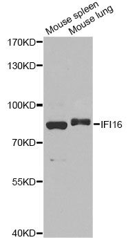 IFI16 Antibody - Western blot analysis of extracts of various cell lines, using IFI16 antibody at 1:1000 dilution. The secondary antibody used was an HRP Goat Anti-Rabbit IgG (H+L) at 1:10000 dilution. Lysates were loaded 25ug per lane and 3% nonfat dry milk in TBST was used for blocking. An ECL Kit was used for detection and the exposure time was 90s.