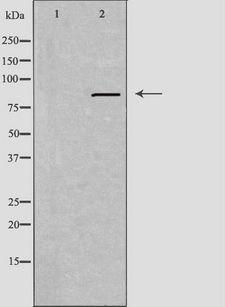 IFI16 Antibody - Western blot analysis of extracts of HeLa cells using IFI16 antibody.