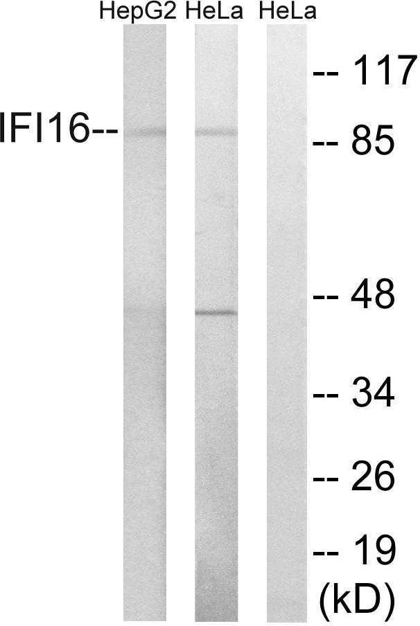 IFI16 Antibody - Western blot analysis of extracts from HeLa cells and HepG2 cells, using IFI16 antibody.