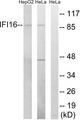 IFI16 Antibody - Western blot analysis of extracts from HeLa cells and HepG2 cells, using IFI16 antibody.