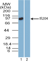 Ifi204 Antibody - Western blot of Ifi204 in mouse heart tissue lysate in the 1) absence and 2) presence of immunizing peptide using Polyclonal Antibody to Ifi204 at3 ug/ml. Goat anti-rabbit Ig HRP secondary antibody, and PicoTect ECL substrate solution were used for this test.