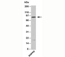 Ifi204 Antibody - IFI204 Antibody western blot of mouse samples