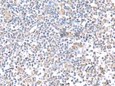 IFI27 / p27 Antibody - Immunohistochemistry of paraffin-embedded Human tonsil tissue  using IFI27 Polyclonal Antibody at dilution of 1:80(×200)