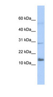 IFI27L2 Antibody - IFI27L2 / FAM14A antibody Western blot of Transfected 293T cell lysate. This image was taken for the unconjugated form of this product. Other forms have not been tested.
