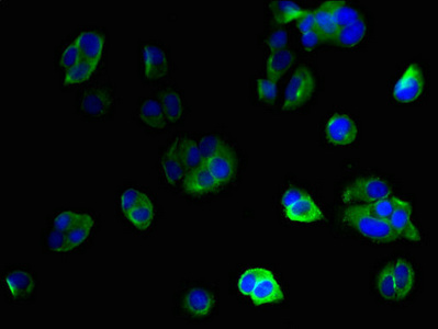 IFI27L2 Antibody - Immunofluorescent analysis of MCF-7 cells using IFI27L2 Antibody at dilution of 1:100 and Alexa Fluor 488-congugated AffiniPure Goat Anti-Rabbit IgG(H+L)