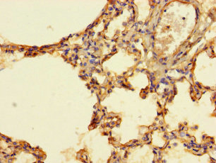 IFI27L2 Antibody - Immunohistochemistry of paraffin-embedded human lung tissue using IFI27L2 Antibody at dilution of 1:100