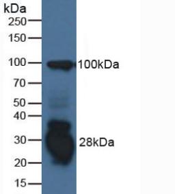 IFI30 / IP30 Antibody - Western Blot; Sample: Human Raji Cells.