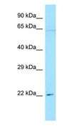 IFI30 / IP30 Antibody - IFI30 / IP30 antibody Western Blot of HeLa.  This image was taken for the unconjugated form of this product. Other forms have not been tested.