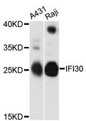 IFI30 / IP30 Antibody - Western blot analysis of extracts of various cell lines, using IFI30 antibody at 1:3000 dilution. The secondary antibody used was an HRP Goat Anti-Rabbit IgG (H+L) at 1:10000 dilution. Lysates were loaded 25ug per lane and 3% nonfat dry milk in TBST was used for blocking. An ECL Kit was used for detection and the exposure time was 60s.