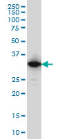 IFI35 Antibody - IFI35 monoclonal antibody (M01), clone 3H6 Western Blot analysis of IFI35 expression in A-431.