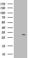 IFI35 Antibody - HEK293T cells were transfected with the pCMV6-ENTRY control (Left lane) or pCMV6-ENTRY IFI35 (Right lane) cDNA for 48 hrs and lysed. Equivalent amounts of cell lysates (5 ug per lane) were separated by SDS-PAGE and immunoblotted with anti-IFI35.