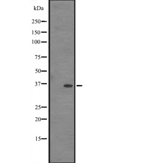 IFI35 Antibody - Western blot analysis of IN35 expression in HEK293 cells. The lane on the left is treated with the antigen-specific peptide.