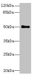 IFI44 Antibody - Western blot All lanes: IFI44 antibody at 6µg/ml + Mouse lung tissue Secondary Goat polyclonal to rabbit IgG at 1/10000 dilution Predicted band size: 51, 15 kDa Observed band size: 51 kDa