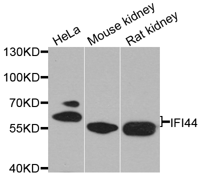 IFI44 Antibody - Western blot analysis of extracts of various cell lines.