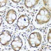 IFI44 Antibody - Immunohistochemistry of paraffin-embedded human colon tissue.
