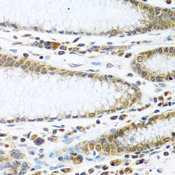 IFI44 Antibody - Immunohistochemistry of paraffin-embedded human stomach tissue.