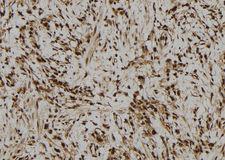 IFI44 Antibody - 1:100 staining human gastric tissue by IHC-P. The sample was formaldehyde fixed and a heat mediated antigen retrieval step in citrate buffer was performed. The sample was then blocked and incubated with the antibody for 1.5 hours at 22°C. An HRP conjugated goat anti-rabbit antibody was used as the secondary.